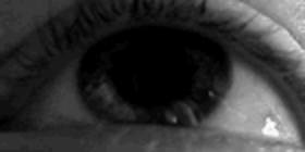Involuntary eye movements