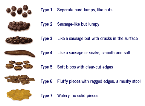 A type 6 - 7 stool can be classified as diarrhea.